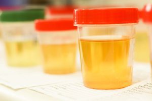 Tout savoir sur les tests urinaires au THC test urine thc